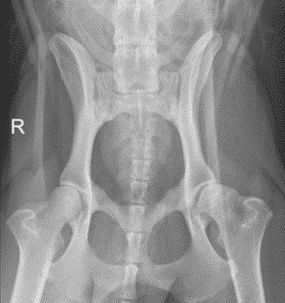 Hip x-ray
