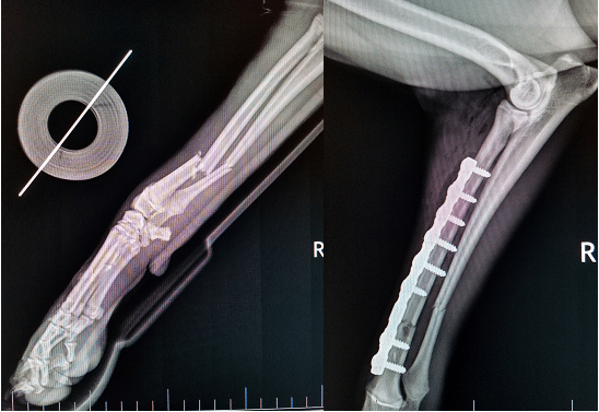 Advanced facture repair x-ray